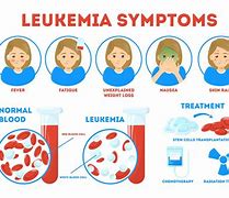 Image result for Acute Myeloid Leukemia Disease