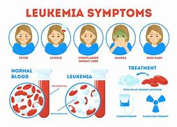 Image result for Leukemia Stage 1