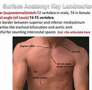 Image result for Notch Structure