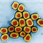 Image result for Smallpox Plague