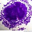 Image result for sctinomicosis