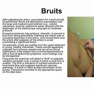 Image result for Vascular Bruits