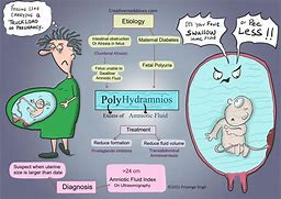 Image result for Anencephaly Cartoon