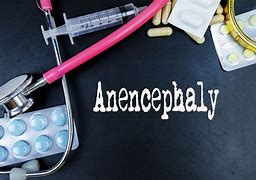 Image result for Types of Anencephaly