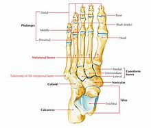 Image result for Base of 5th Metatarsal Apophysis