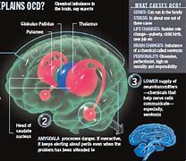 Image result for OCD Brain Structure