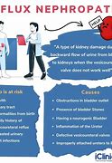 Image result for Reflux Nephropathy