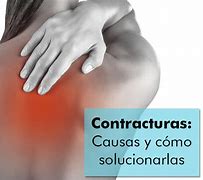 Image result for contractura