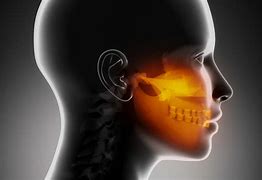 Image result for Jaw Bone Cancer