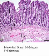 Image result for Large Intestine Histology Slides