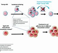 Image result for AML Cancer