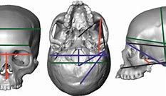 Image result for Human Skull Dimensions
