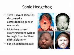 Image result for Sonic Hedgehog Mutation