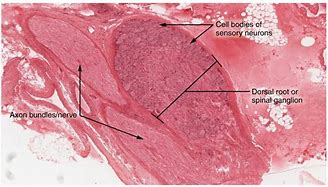 Image result for Pelham Bit Labeled