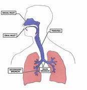 Image result for Airway Bypass