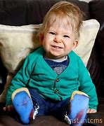 Image result for Babies with No Brain