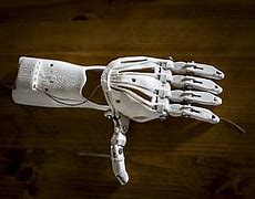 Image result for Prosthetic Arm 3D Model