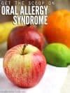 Image result for Oral Allergy Syndrome Apple's