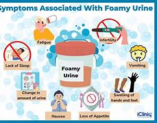 Image result for Bubbles in Urine Diabetes