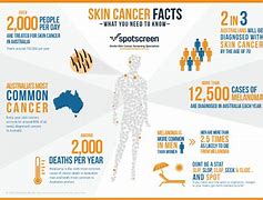 Image result for Sun Killing People with Skin Cancer