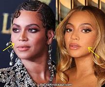 Image result for Beyonce Face Lift