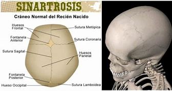 Image result for sinarfrosis
