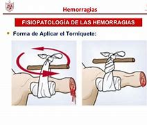 Image result for hemorragis