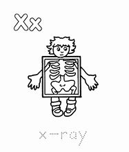 Image result for Dawg in Me X-ray