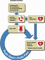 Image result for Adult CPR Steps