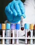 Image result for Laboratory Testing