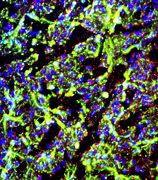 Image result for Astrocytes Fluorescence