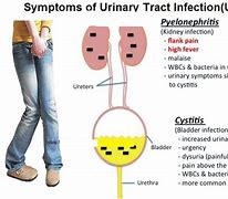Image result for Diagnosis of UTI