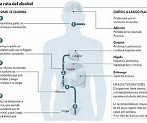 Image result for alcohilemia