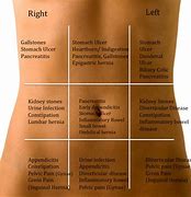 Image result for Body Pain Left Side Abdomen