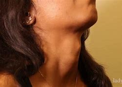 Image result for Woman Adam Apple