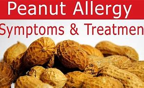 Image result for Peanut Allergic Reaction
