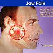 Image result for Jaw Pain Cancer