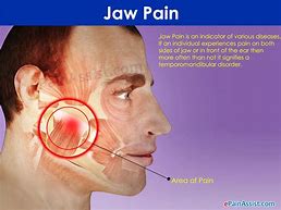 Image result for Jaw Pain Areas