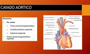 Image result for braquiocef�lico