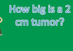 Image result for 4 Cm Tumor