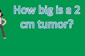 Image result for 2 Cm Bladder Tumor