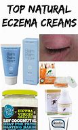 Image result for Eczema Lotion Natural