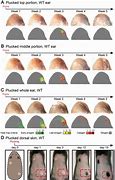 Image result for Hair Density Chart