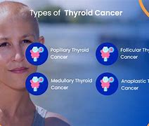 Image result for IP 6 Cancer Testimonials