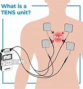 Image result for iPhone Tens Unit