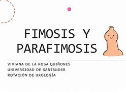 Image result for fimosis