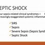 Image result for Shock Site Collection
