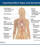 Image result for Hypothyroidism Disease