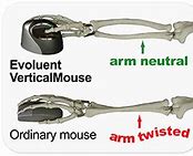 Image result for Evoluent Vertical Mouse 4