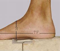 Image result for Foot Arch Length